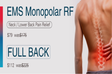 EMS Monopolar RF Pain Relief